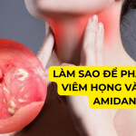 Làm sao để phân biệt viêm họng và viêm amidan như một chuyên gia y tế?