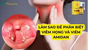 Làm sao để phân biệt viêm họng và viêm amidan như một chuyên gia y tế? 1