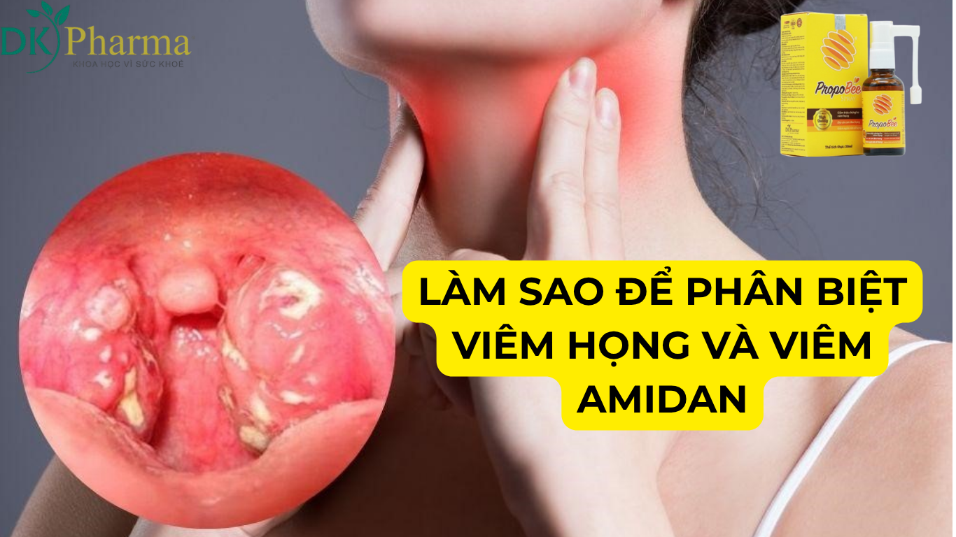 Làm sao để phân biệt viêm họng và viêm amidan như một chuyên gia y tế?