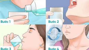 3. Quy trình 5 phút súc miệng giảm đau họng chuẩn y khoa 1