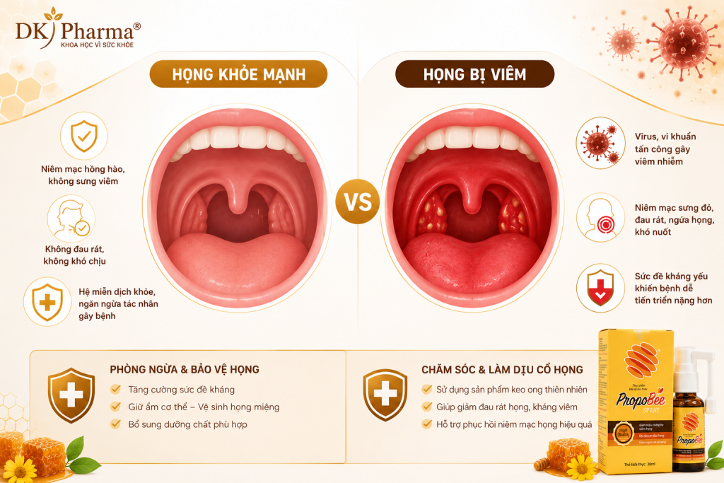 Chúng ta thường nhầm lẫn giữa viêm họng do cảm cúm (do virus) và viêm họng (do vi khuẩn, đặc biệt là liên cầu 1
