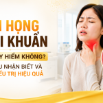 Viêm họng do vi khuẩn có nguy hiểm không? Dấu hiệu nhận biết và cách điều trị hiệu quả