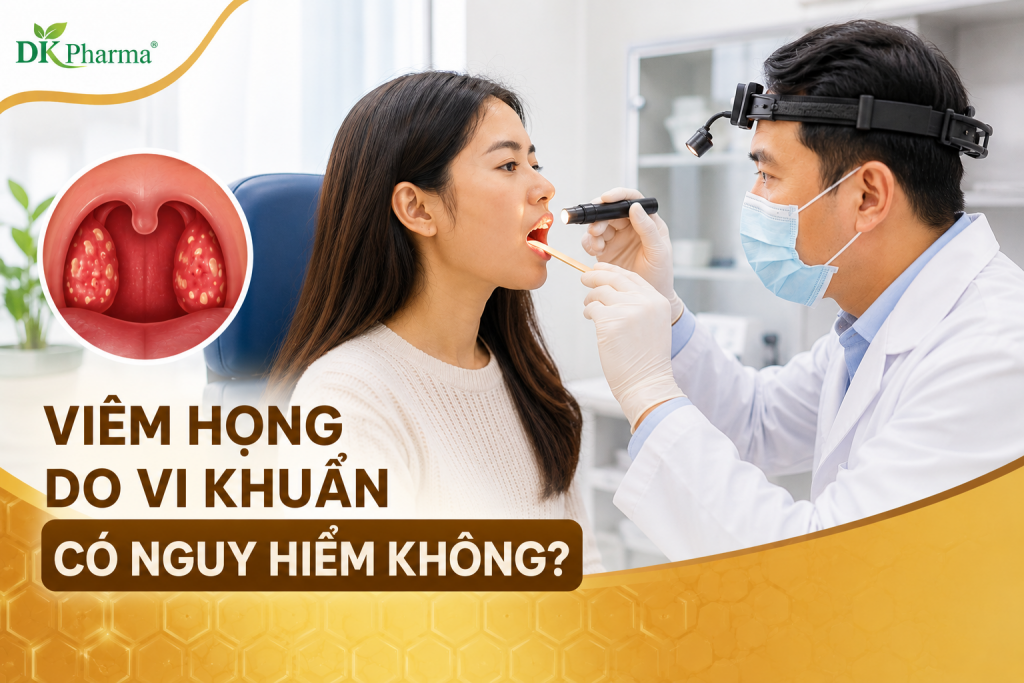 Viêm họng do vi khuẩn có nguy hiểm không? Dấu hiệu nhận biết và cách điều trị hiệu quả 1